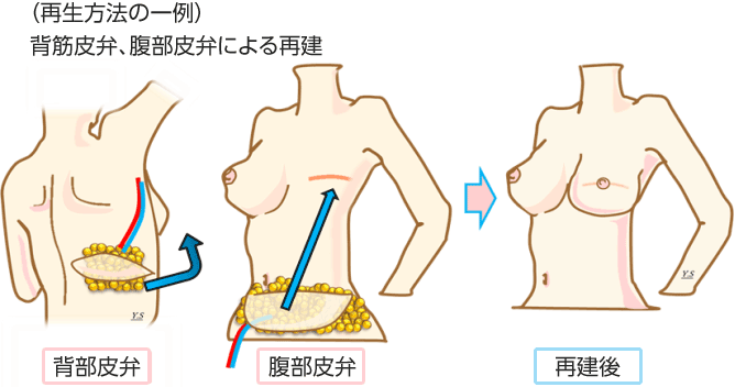 再生方法の一例