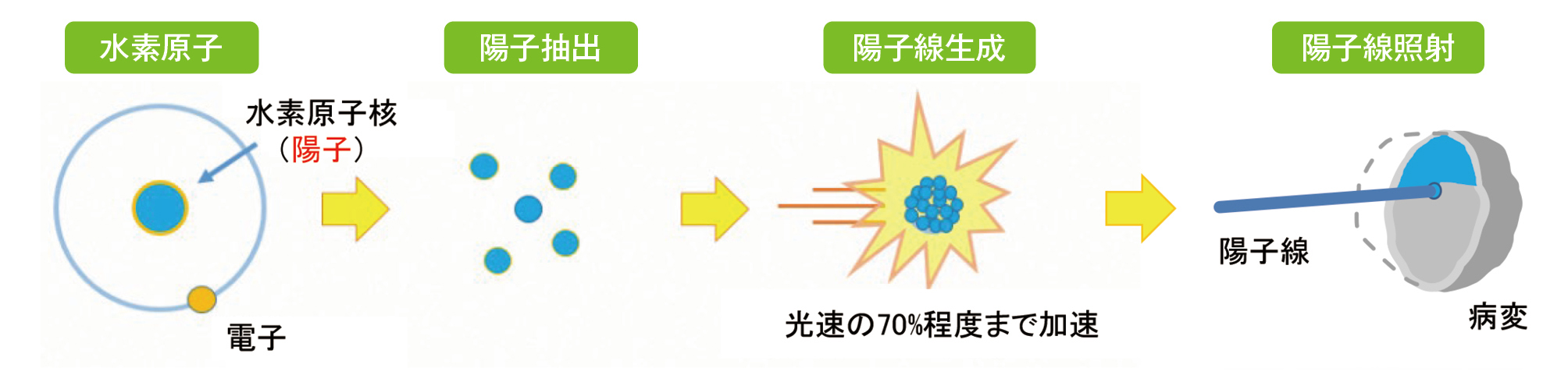 陽子線治療とは